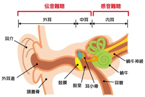 難聴の種類