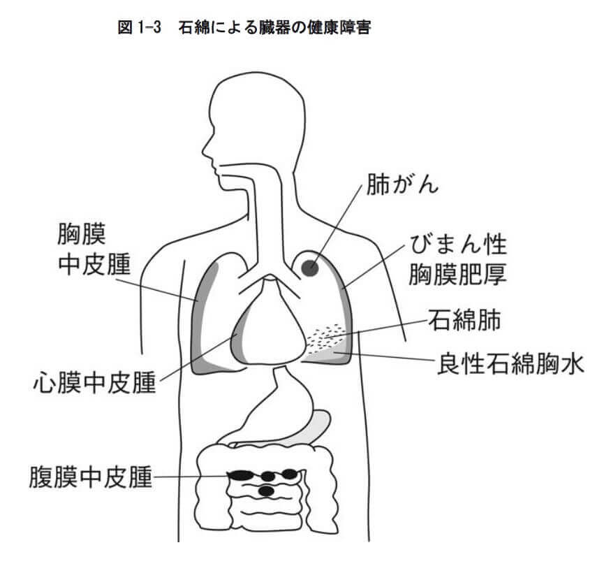 図
1 3 石綿による臓器の健康障害