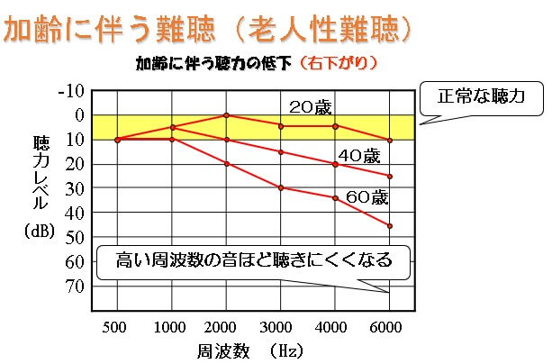 加齢に伴う難聴