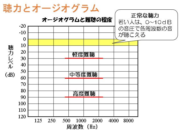 （１１）聴力図（オージオグラム）について