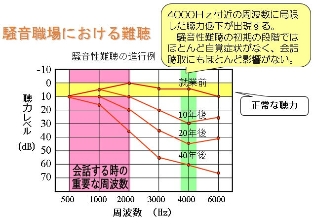 騒音による難聴